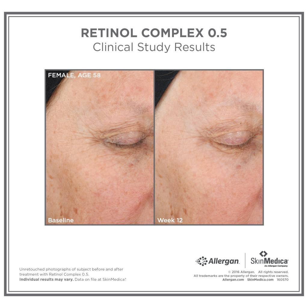 Retinol Complex (29.6 ml / 1 fl oz.)