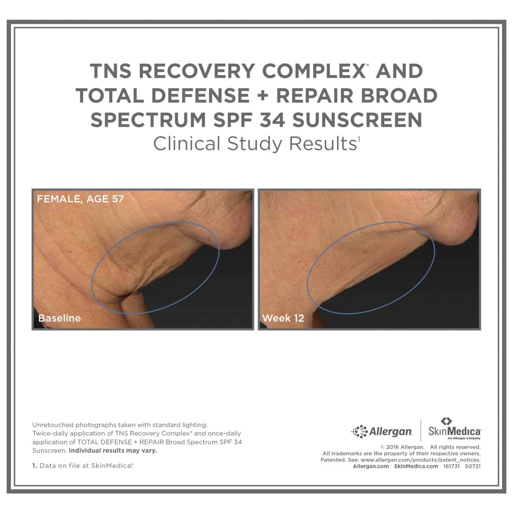 TNS Recovery Complex
