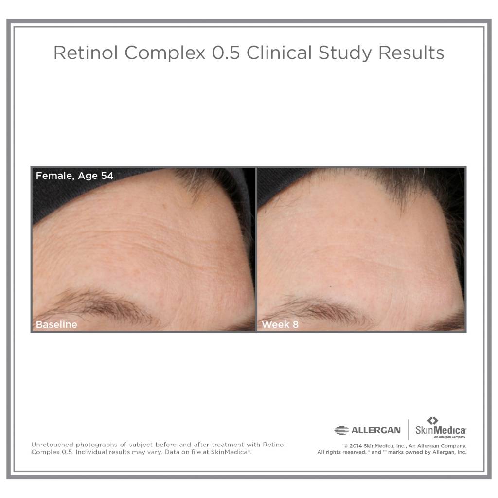 Retinol Complex (29.6 ml / 1 fl oz.)