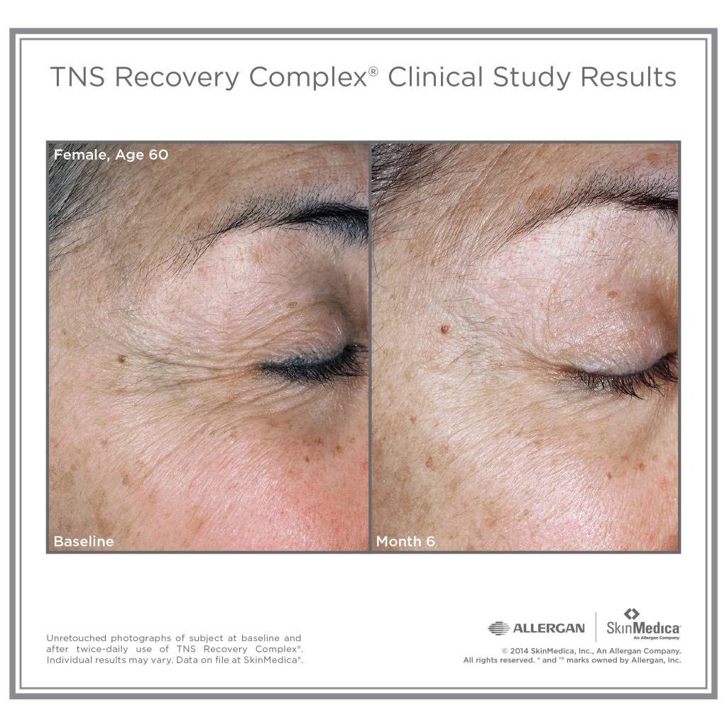 TNS Recovery Complex